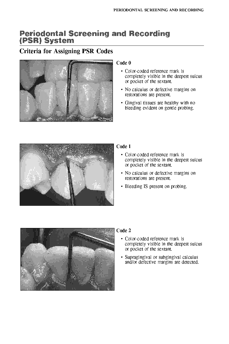 periodontal screening and recording